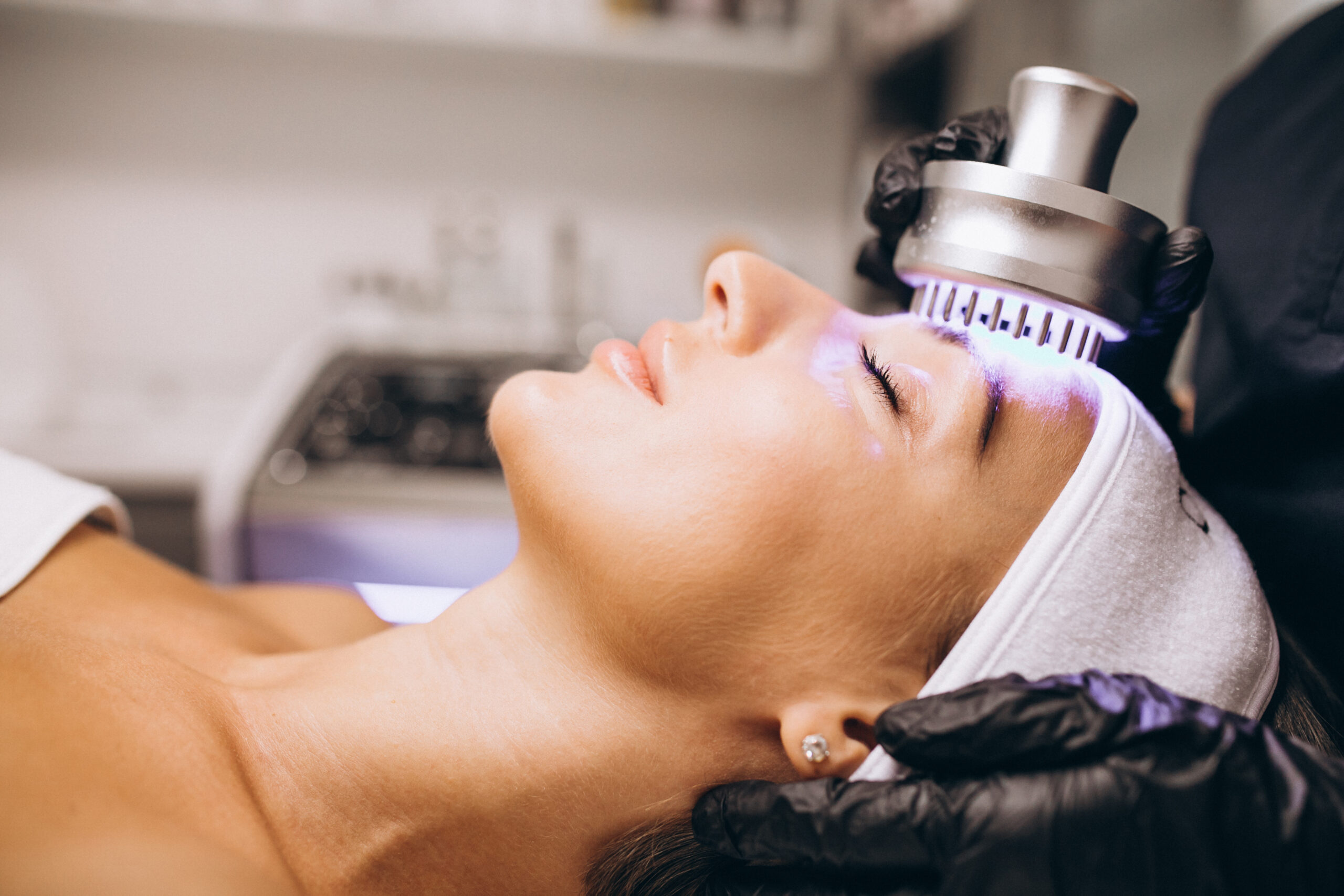 Woman receiving a laser skin tightening treatment on her forehead.